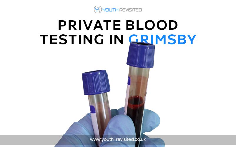 Private Blood Testing in Grimsby : Improve Wellness and Athletics Performance