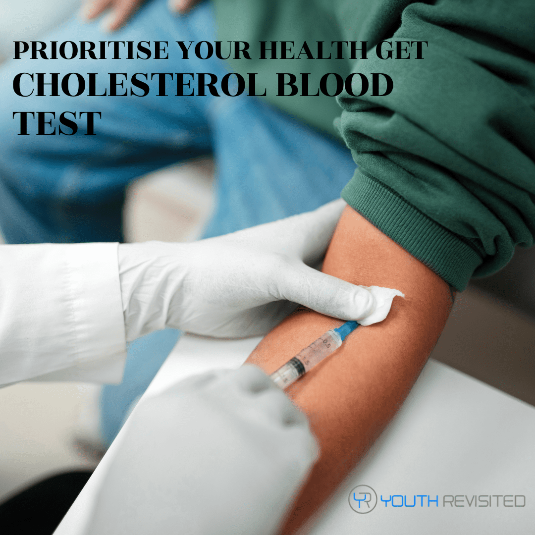 Cholestroal Blood Test